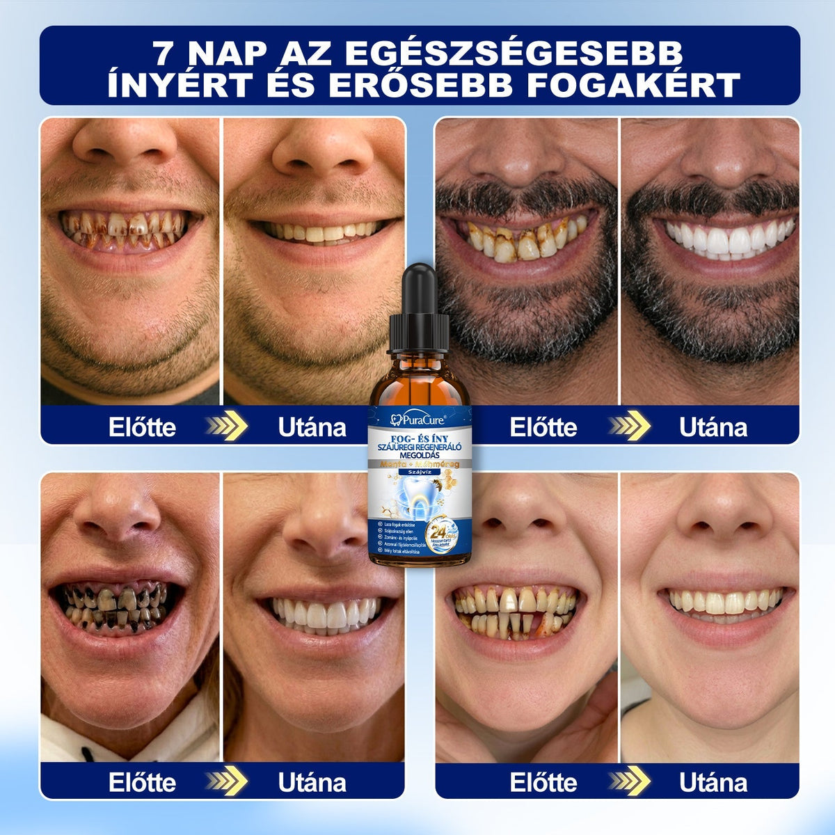 🦷𝐇𝐢𝐯𝐚𝐭𝐚𝐥𝐨𝐬 Á𝐫𝐮𝐡á𝐳 | 𝐏𝐮𝐫𝐚𝐂𝐮𝐫𝐞® 𝐅𝐨𝐠- é𝐬 Í𝐧𝐲 𝐒𝐳á𝐣ü𝐫𝐞𝐠𝐢 𝐑𝐞𝐠𝐞𝐧𝐞𝐫á𝐥ó 𝐎𝐥𝐝𝐚𝐭 | 𝐌é𝐡𝐦é𝐫𝐞𝐠-𝐩𝐞𝐩𝐭𝐢𝐝𝐞𝐤 × 𝐊𝐨𝐥𝐥𝐚𝐠é𝐧 × 𝐏𝐨𝐬𝐳𝐭𝐛𝐢𝐨𝐭𝐢𝐤𝐮𝐦𝐨𝐤 × 𝐁é𝐭𝐚-𝐠𝐥ü𝐤𝐚𝐧á𝐳 𝐞𝐫𝐞𝐣é𝐯𝐞𝐥 𝐚 𝐥𝐞𝐩𝐞𝐝é𝐤, 𝐟𝐨𝐠𝐤ő, 𝐟𝐨𝐠𝐟á𝐣á𝐬, 𝐫𝐨𝐬𝐬𝐳 𝐥𝐞𝐡𝐞𝐥𝐞𝐭 é𝐬 𝐠𝐲𝐞𝐧𝐠𝐞 𝐟𝐨𝐠𝐚𝐤 𝐞𝐥𝐥𝐞𝐧