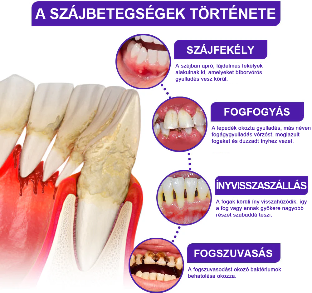 🌟A magyarok kedvence丨Rolimey® VioCore Méhméreg Fogkezelő Fogkrém-🌻