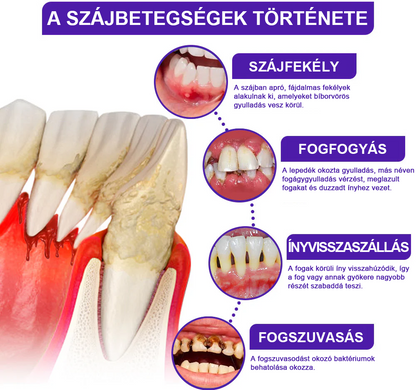 🌟A magyarok kedvence丨Rolimey® VioCore Méhméreg Fogkezelő Fogkrém-🌻