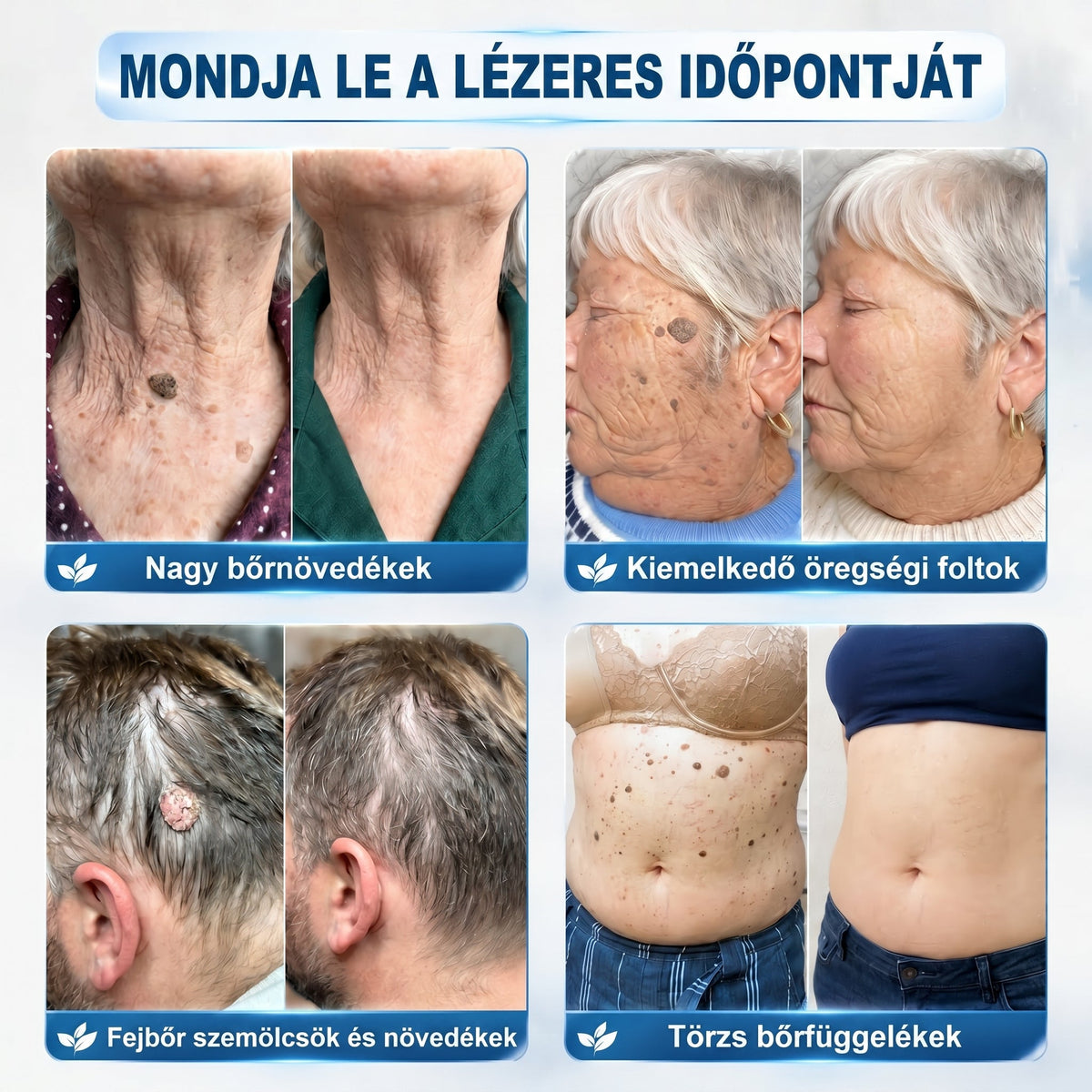 𝑯𝒊𝒗𝒂𝒕𝒂𝒍𝒐𝒔 𝒎á𝒓𝒌𝒂𝒃𝒐𝒍𝒕✅ | 𝑷𝒊𝒄𝒅𝒐® 7 𝒏𝒂𝒑𝒐𝒔 𝒃ő𝒓𝒌𝒊𝒏ö𝒗é𝒔- é𝒔 𝒇𝒐𝒍𝒕𝒆𝒍𝒕á𝒗𝒐𝒍í𝒕ó 𝒕𝒐𝒍𝒍 👩‍⚕️(𝒇á𝒋𝒅𝒂𝒍𝒐𝒎𝒎𝒆𝒏𝒕𝒆𝒔, 𝒉𝒆𝒈 𝒏é𝒍𝒌ü𝒍𝒊, 𝒑𝒓𝒆𝒄í𝒛𝒊ó𝒔 𝒈𝒐𝒍𝒚ó𝒔 𝒂𝒑𝒑𝒍𝒊𝒌á𝒕𝒐𝒓) - ⭐️