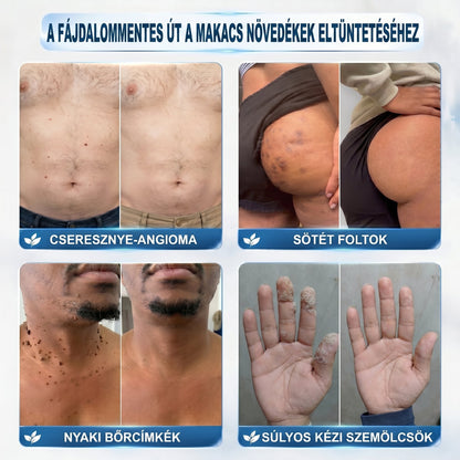 𝑯𝒊𝒗𝒂𝒕𝒂𝒍𝒐𝒔 𝒎á𝒓𝒌𝒂𝒃𝒐𝒍𝒕✅ | 𝑷𝒊𝒄𝒅𝒐® 7 𝒏𝒂𝒑𝒐𝒔 𝒃ő𝒓𝒌𝒊𝒏ö𝒗é𝒔- é𝒔 𝒇𝒐𝒍𝒕𝒆𝒍𝒕á𝒗𝒐𝒍í𝒕ó 𝒕𝒐𝒍𝒍 👩‍⚕️(𝒇á𝒋𝒅𝒂𝒍𝒐𝒎𝒎𝒆𝒏𝒕𝒆𝒔, 𝒉𝒆𝒈 𝒏é𝒍𝒌ü𝒍𝒊, 𝒑𝒓𝒆𝒄í𝒛𝒊ó𝒔 𝒈𝒐𝒍𝒚ó𝒔 𝒂𝒑𝒑𝒍𝒊𝒌á𝒕𝒐𝒓) - ⭐️