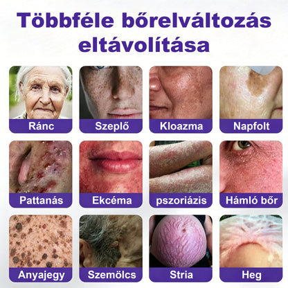 CleraNaure® mikrotűs szemölcs- és anyajegyeltávolító tapasz-🌿