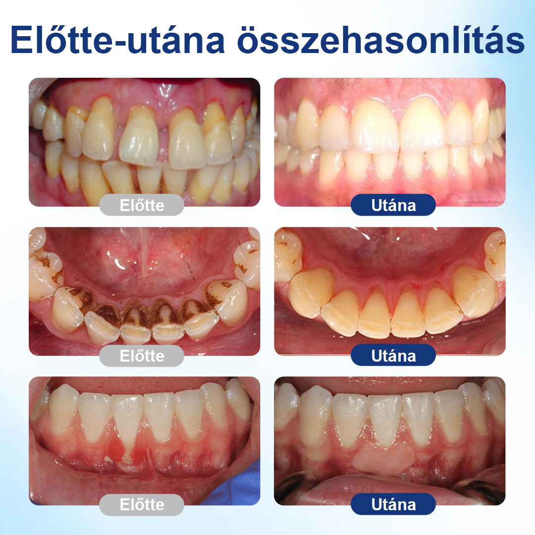 Laleia® BeeTakt szájápoló oldat – friss lehelet és kellemes szájérzet minden nap! Most különleges akciós áron!