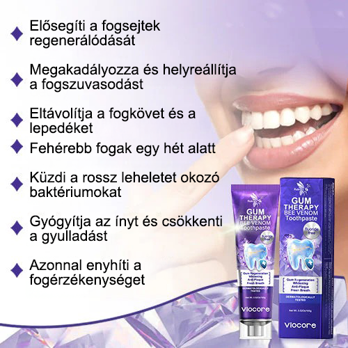 🌟A magyarok kedvence丨Rolimey® VioCore Méhméreg Fogkezelő Fogkrém-🌻