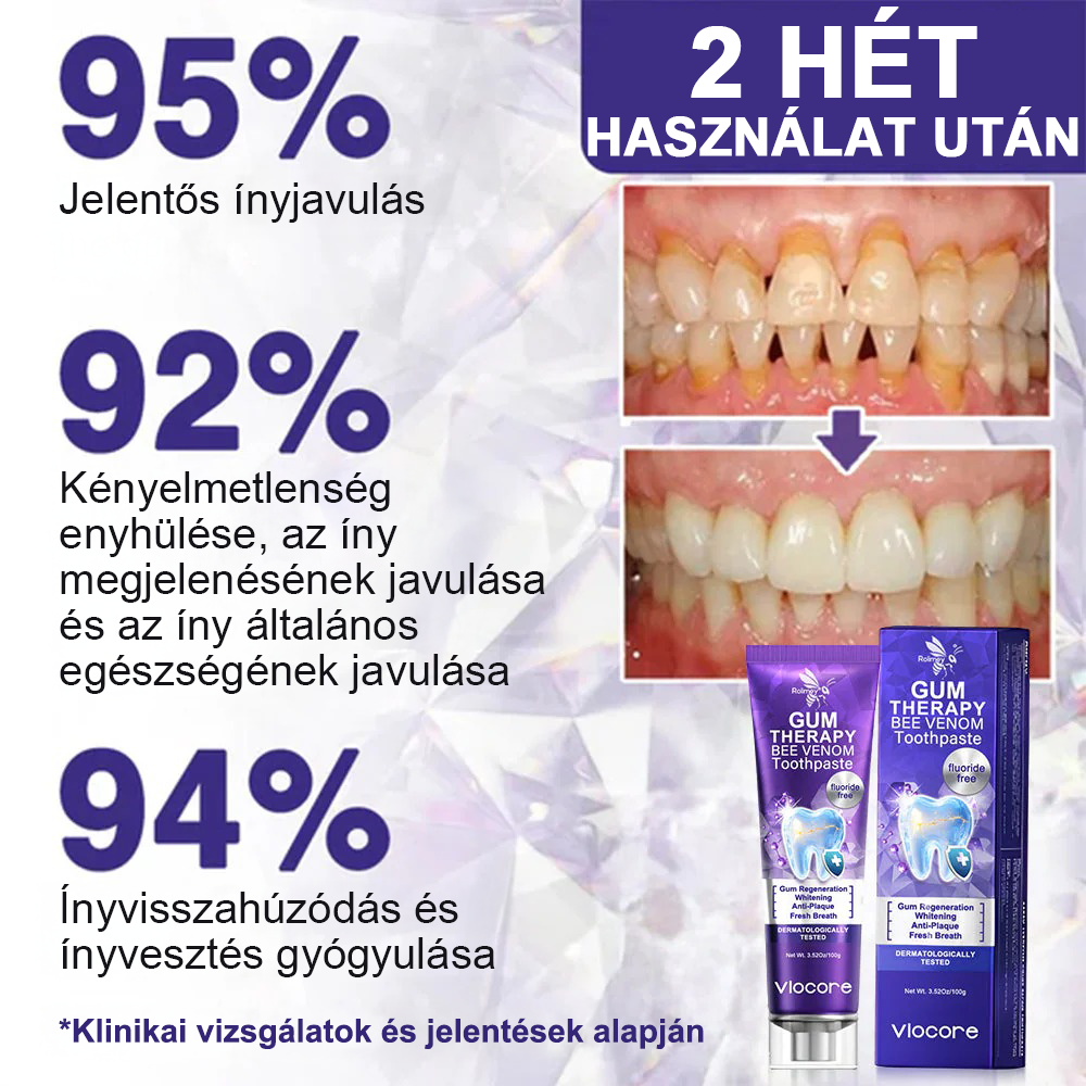 🌟A magyarok kedvence丨Rolimey® VioCore Méhméreg Fogkezelő Fogkrém-🌻
