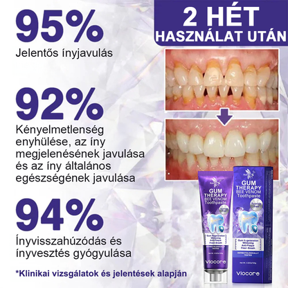 🌟A magyarok kedvence丨Rolimey® VioCore Méhméreg Fogkezelő Fogkrém-🌻