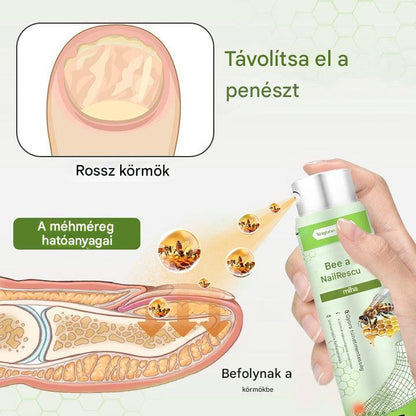 🔥A legnépszerűbb丨Korlátozott ideig 50%-os kedvezmény | Foulme® NailRescue Méhméreg Spray-📦