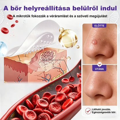 CleraNaure® mikrotűs szemölcs- és anyajegyeltávolító tapasz-🌿
