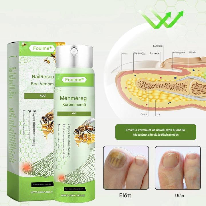🔥A legnépszerűbb丨Korlátozott ideig 50%-os kedvezmény | Foulme® NailRescue Méhméreg Spray-📦