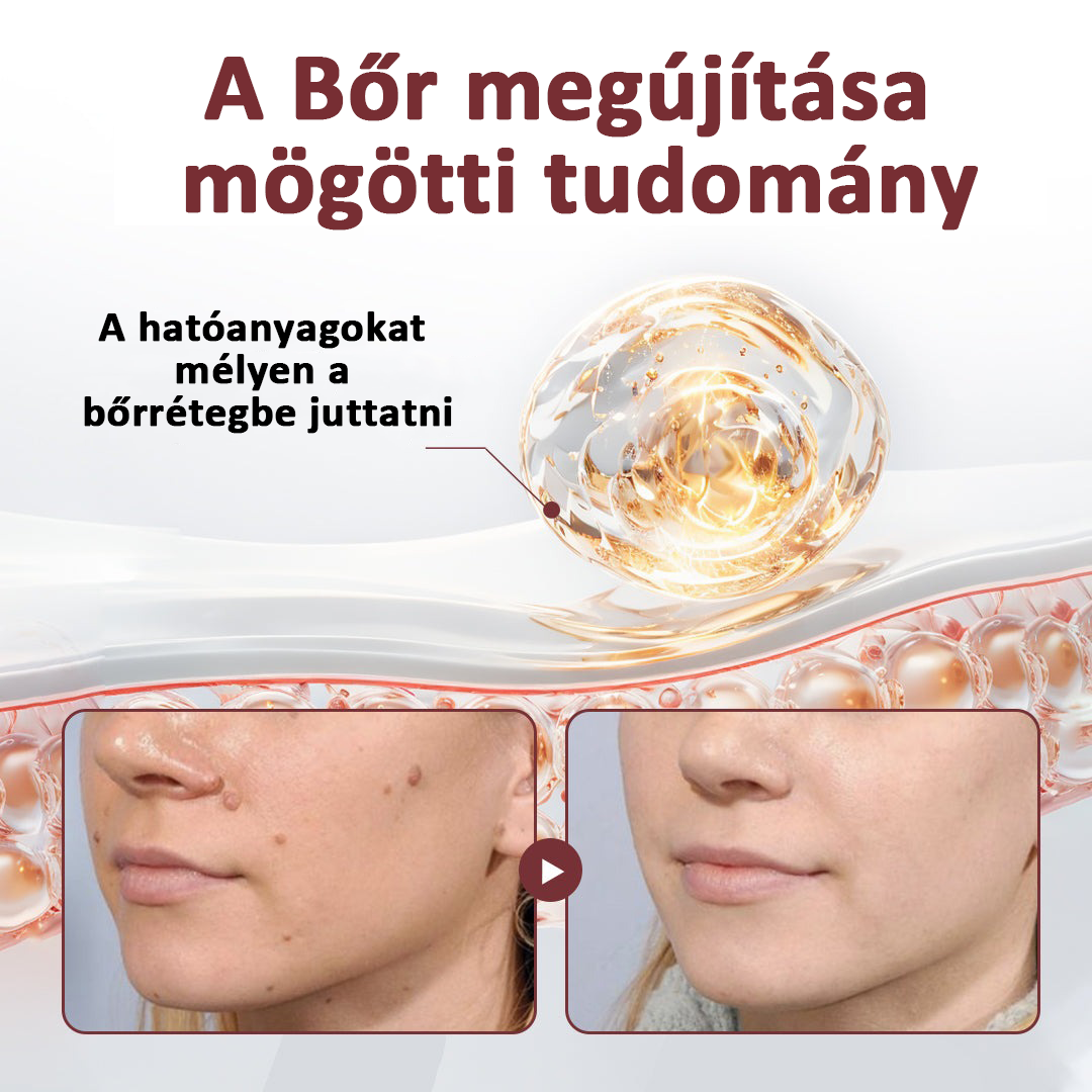 Biancat®KeraErase Dual-Action Renewal Cream