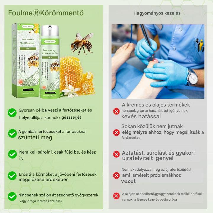 🔥A legnépszerűbb丨Korlátozott ideig 50%-os kedvezmény | Foulme® NailRescue Méhméreg Spray-📦