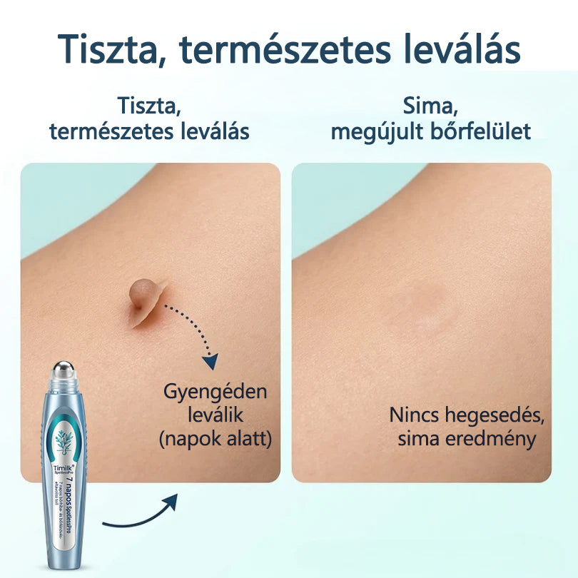 Timilk® SpotlessPro Fejlett Bőrápoló Toll-🌿