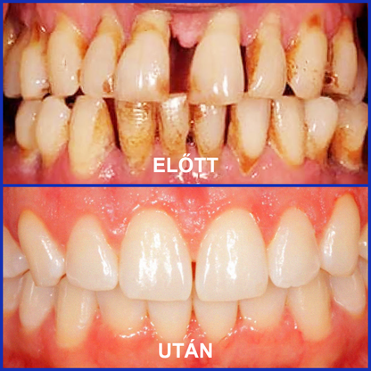🌟A magyarok kedvence丨Rolimey® VioCore Méhméreg Fogkezelő Fogkrém-🌻