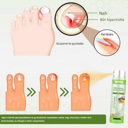 🔥A legnépszerűbb丨Korlátozott ideig 50%-os kedvezmény | Foulme® NailRescue Méhméreg Spray-📦